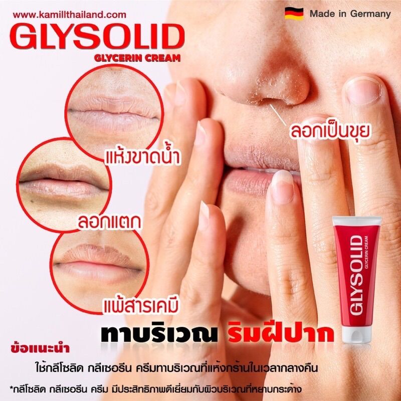 (Bản Đức) Kem trị da khô nẻ Glysolid số 1 của Đức 100ml