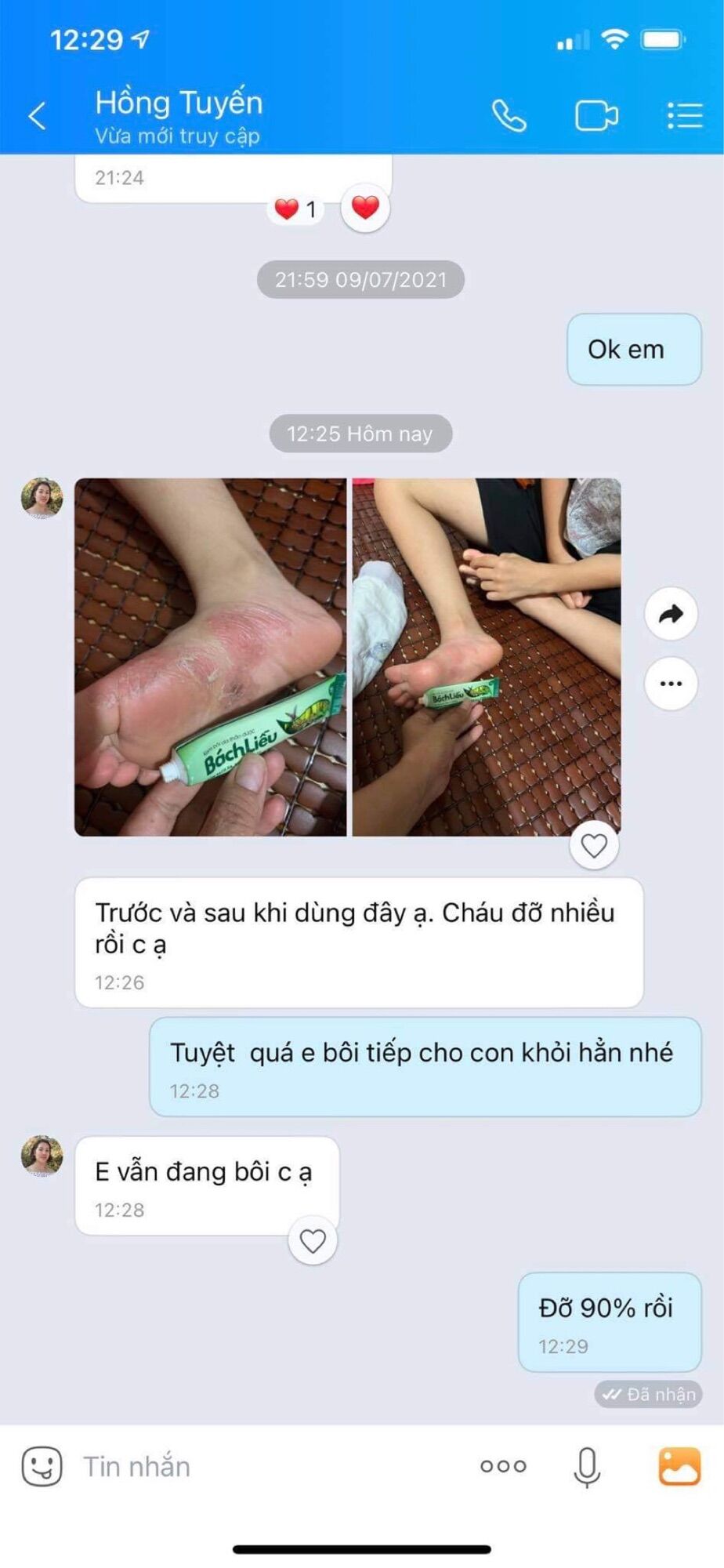 Kem bôi da thảo dược Bách Liễu 15gr