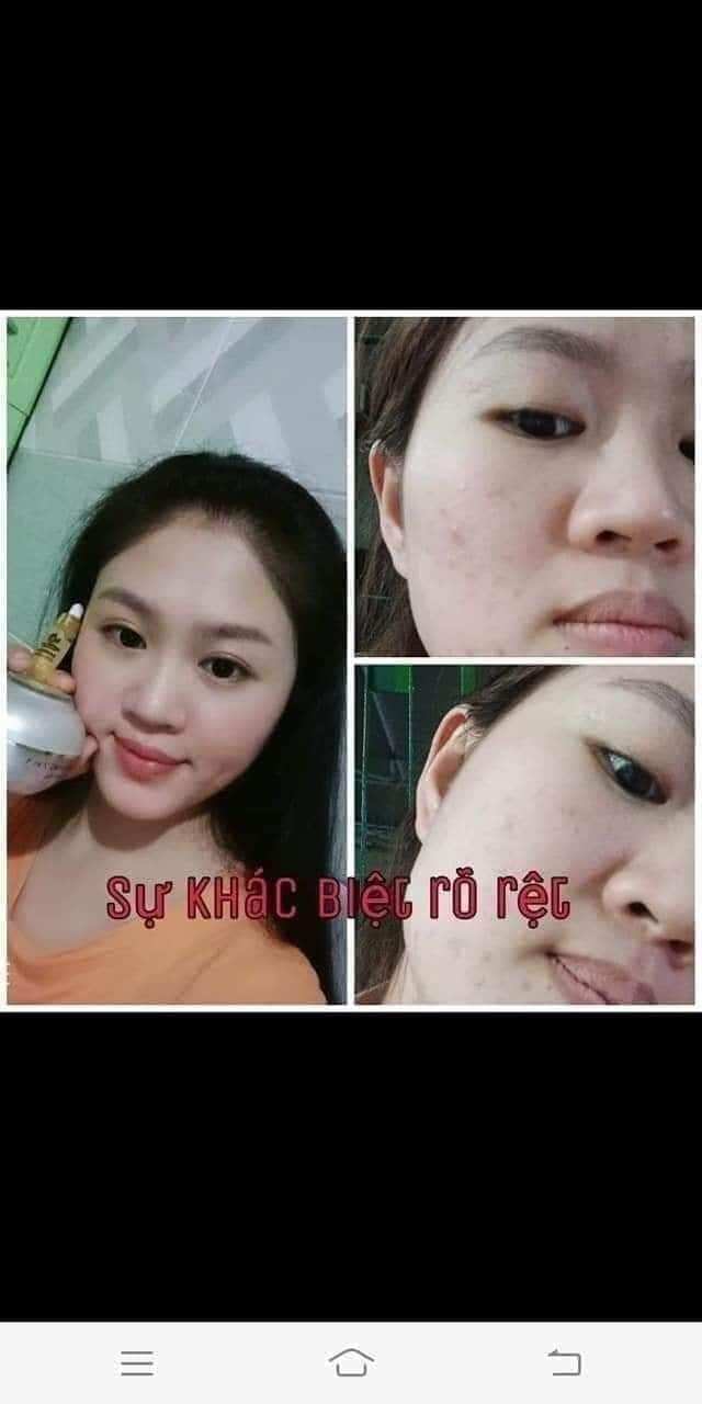 COMBO FACE VIP + SERUM COLLAGEN  HUỲNH ĐỔ ( XÓA MỤN +NÁM +TÀN NHAN +ĐỒI MỒI + TRẮNG DA VVV )