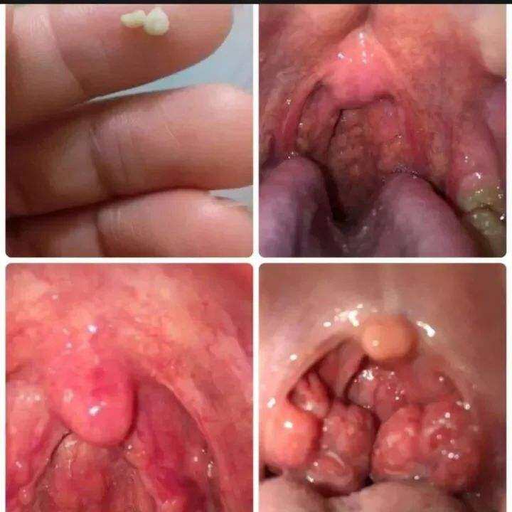 tinh dầu răng miệng Dạ Thảo liên hỗ trợ miệng