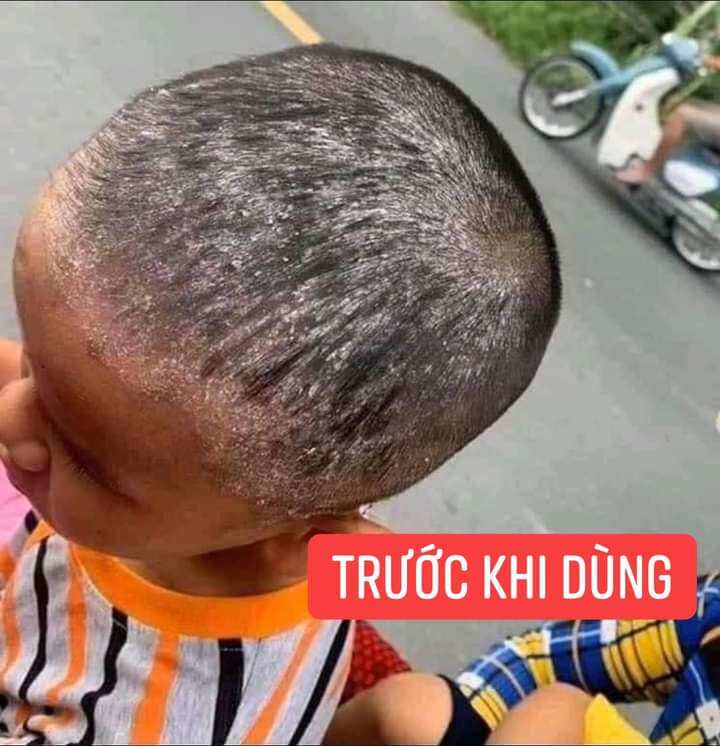 Dầu gội thảo mộc Trần Kim Huyền