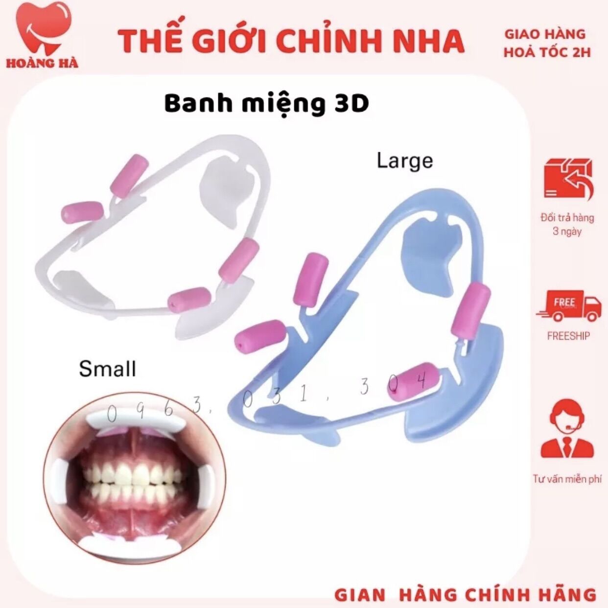 Banh miệng 3D dùng trong nha khoa