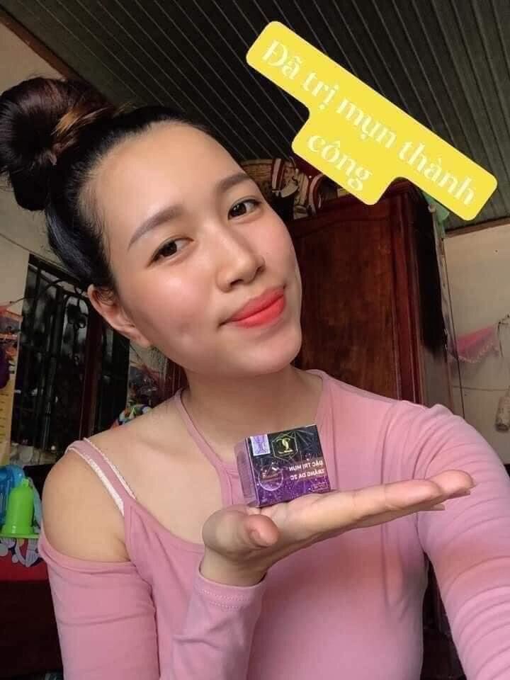 Kem mụn 2c giúp đánh bay mụn nám tàn nhang