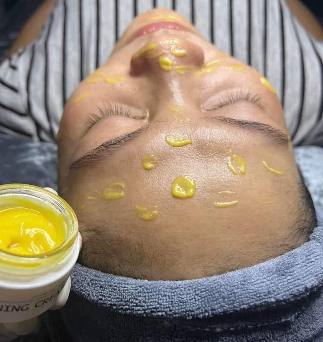 [Lọ Chiet và Fullbox]Thay Da Sinh Học Peel A INNO LIGHTENING CREAM