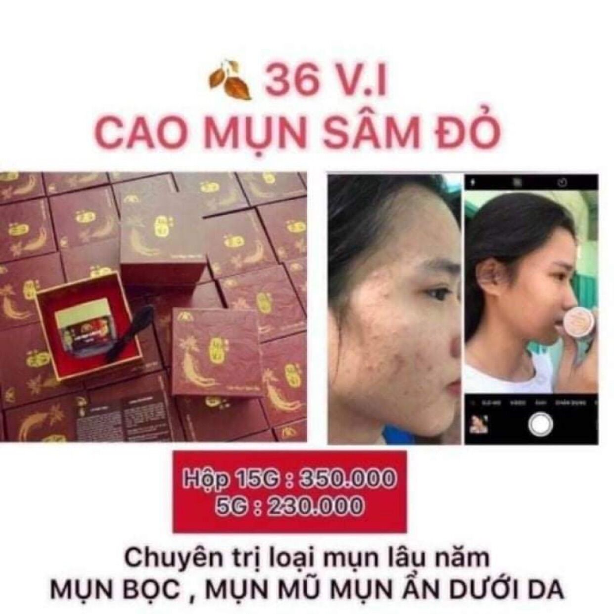 Cao mụn sâm đỏ 15g hàng chính hãng