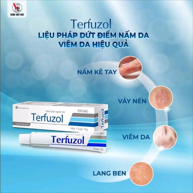 Kem bôi ngoài da TERFUZOL liệu pháp dứt điểm nấm da, viêm da hiệu quả