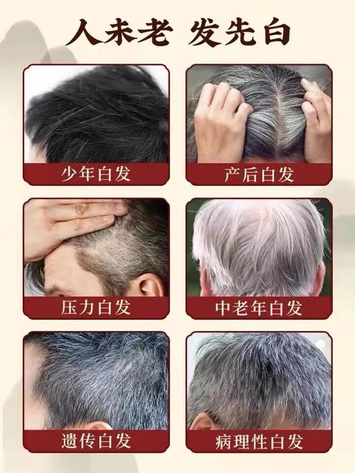 Tinh chất Nhân Sâm giúp mọc tóc ,dày tóc ,tr ị hói và làm đen tóc, óng mượt.