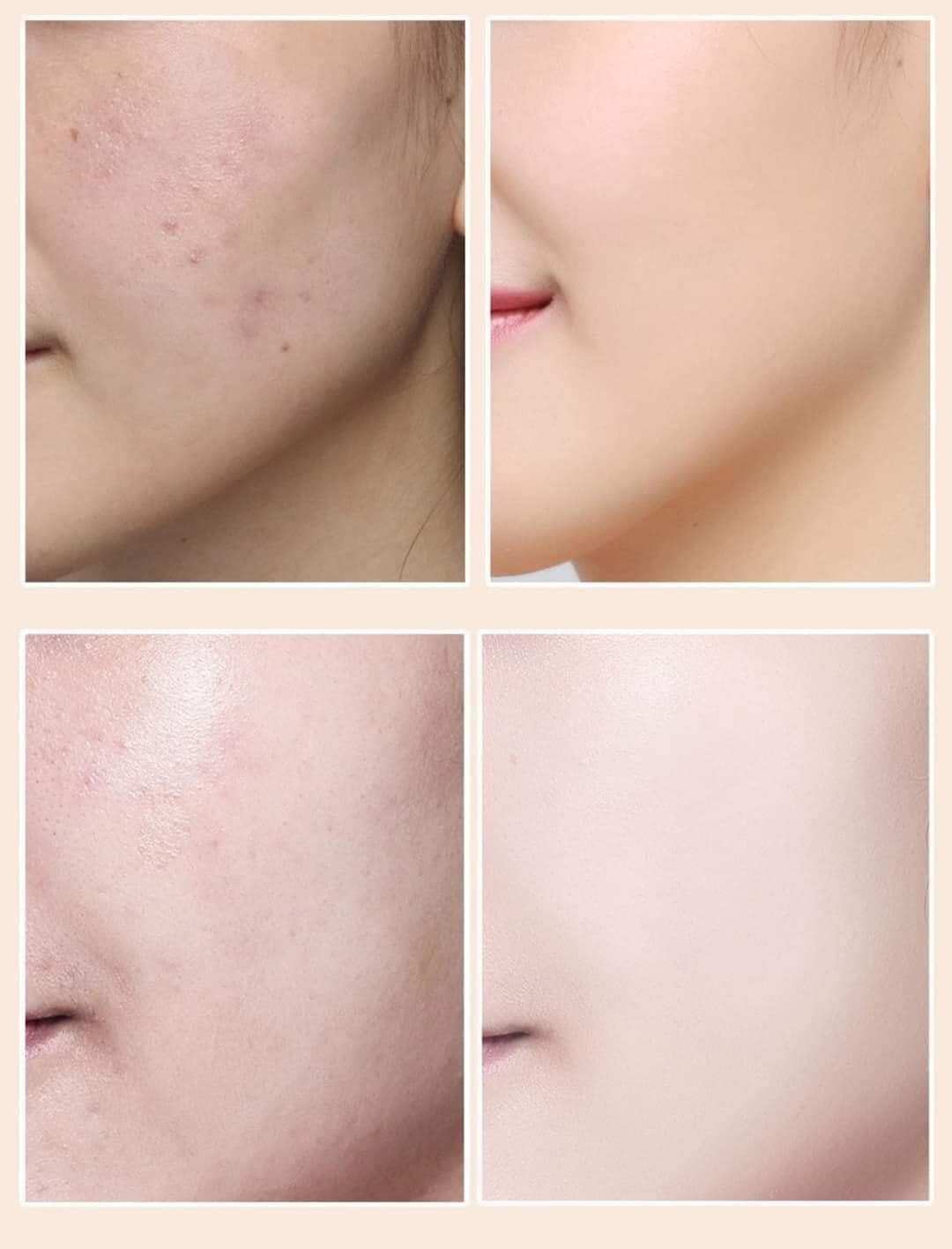 kem nền che khuyết điểm lamela