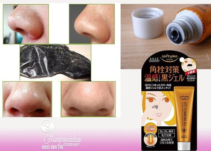 GEL LỘT MỤN KOSE NHẬT BẢN 25g