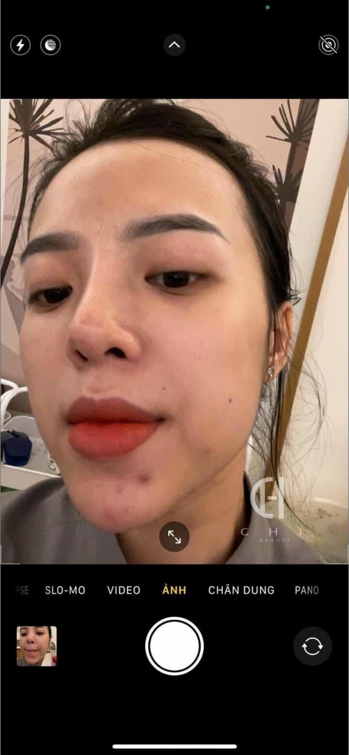 (1 chai)Tinh chất Tái tạo da hồng sâm MC_SKIN (chínhhãng).