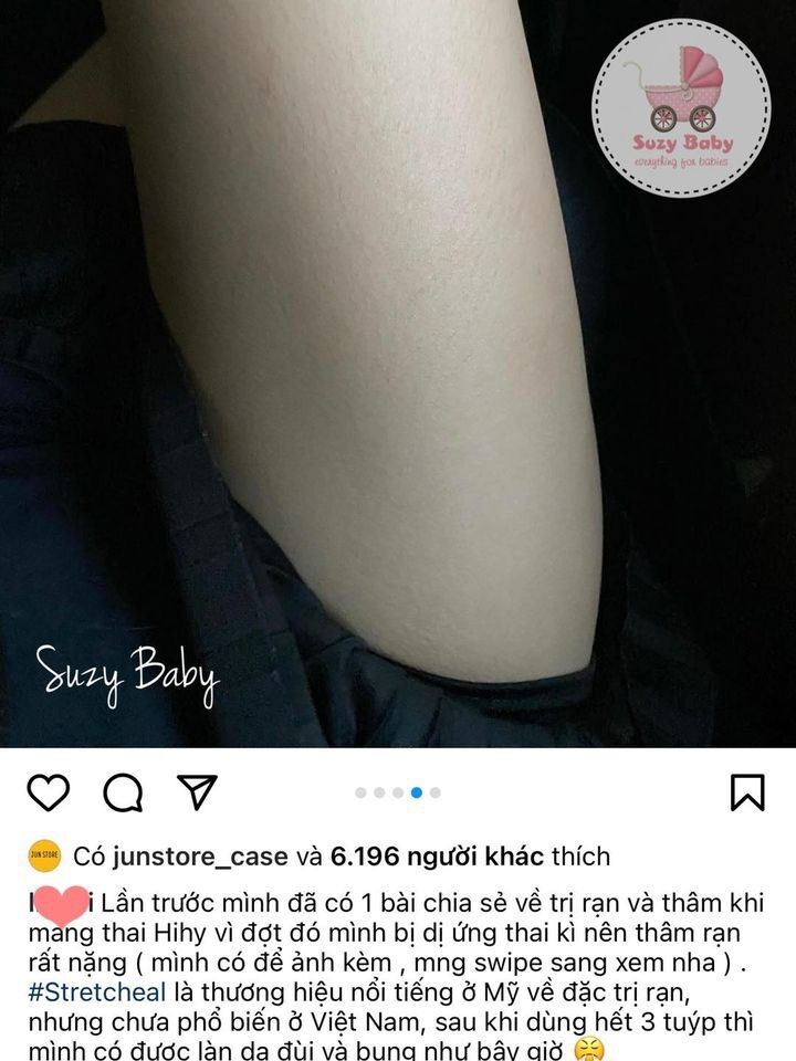 KEM BÔI TRỊ RẠN DA STRECT HEAL