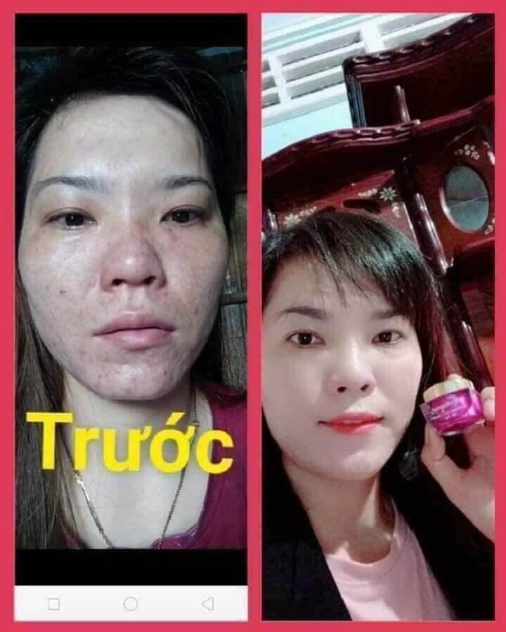 KEM FACE TÍM N COLLAGEN