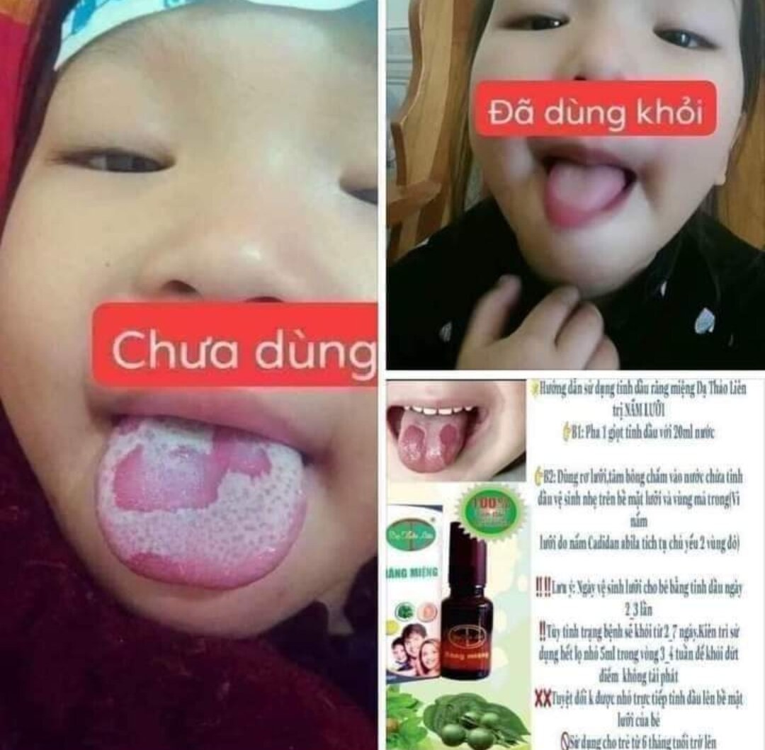 Tinh dầu răng miệng Dạ Thảo Liên 5ml