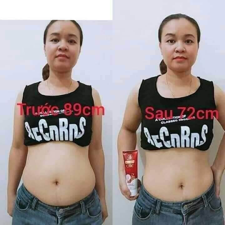 (Combo 2 lọ tan mỡ +1 đai) Kem tan mỡ olic