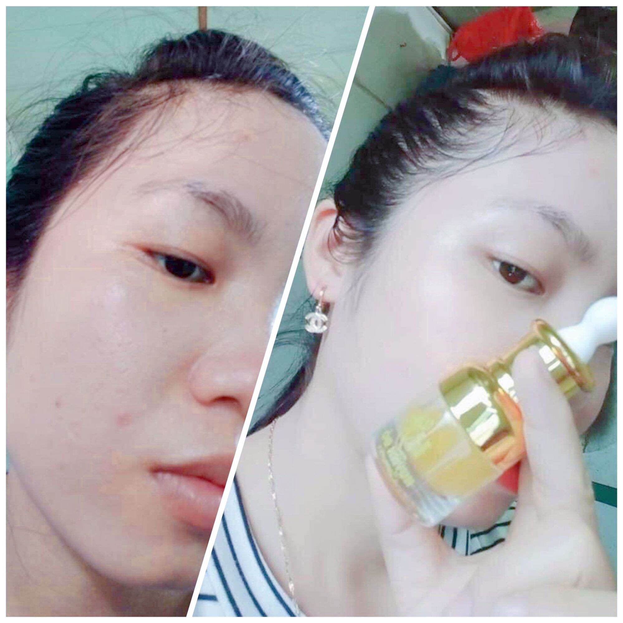 Serum Collagen Huỳnh Đỗ Chính Hãng(Chai 30ml)