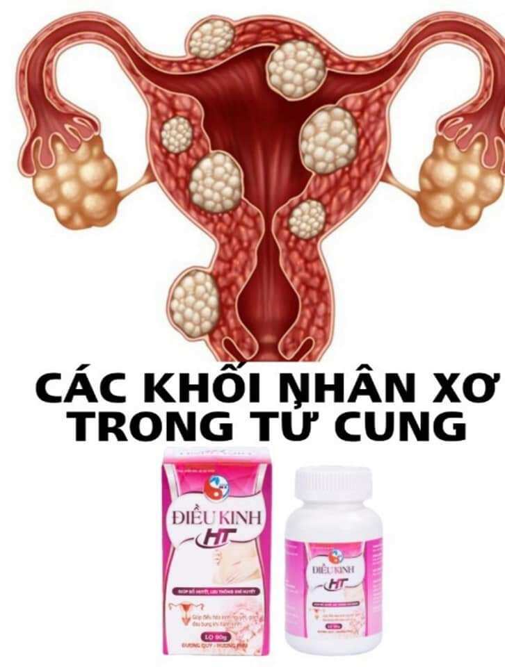 điều kinh HT