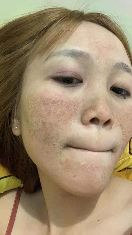 TÁi TẠO DA MỘC DƯƠNG CHÂU 30ML