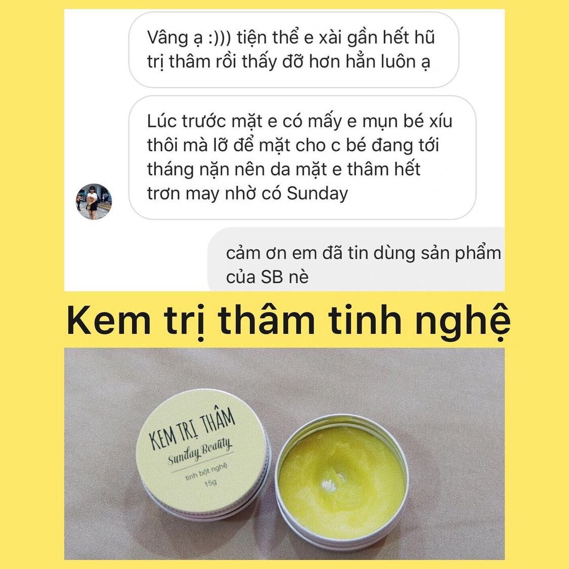 Kem thâm handmade Sunday Beauty