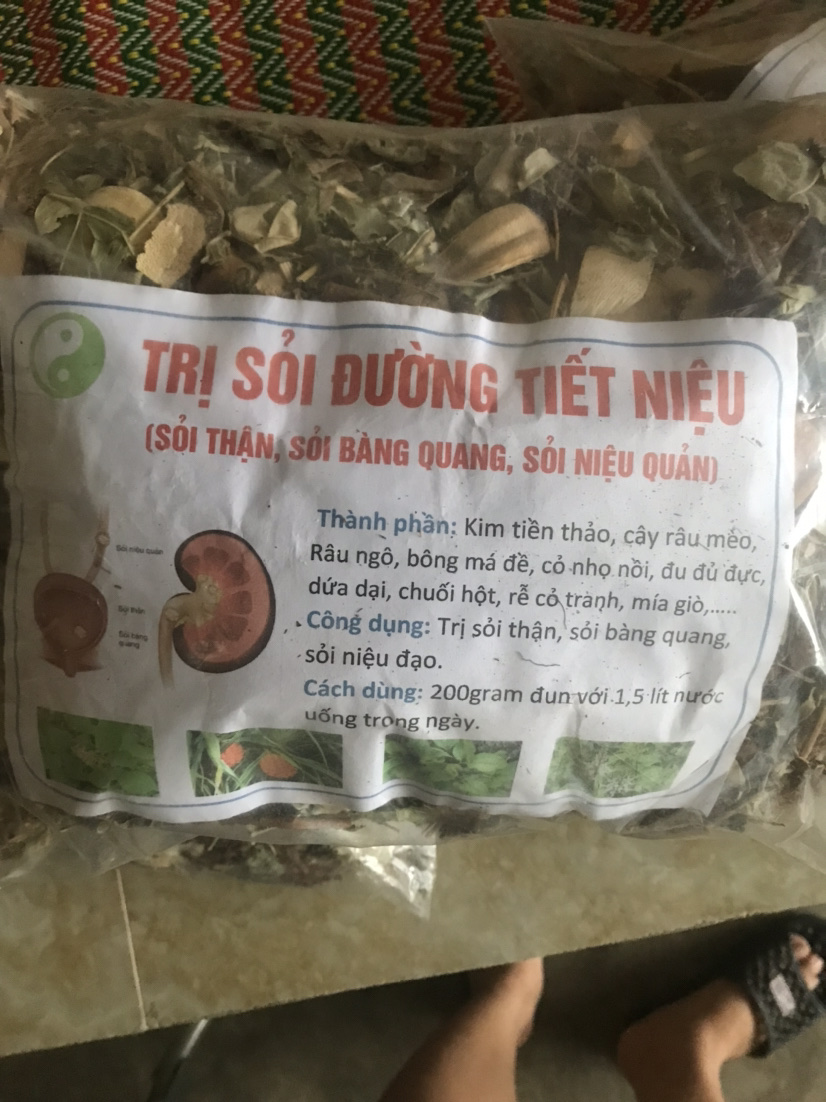 Thang lá sỏi thận (1kg)