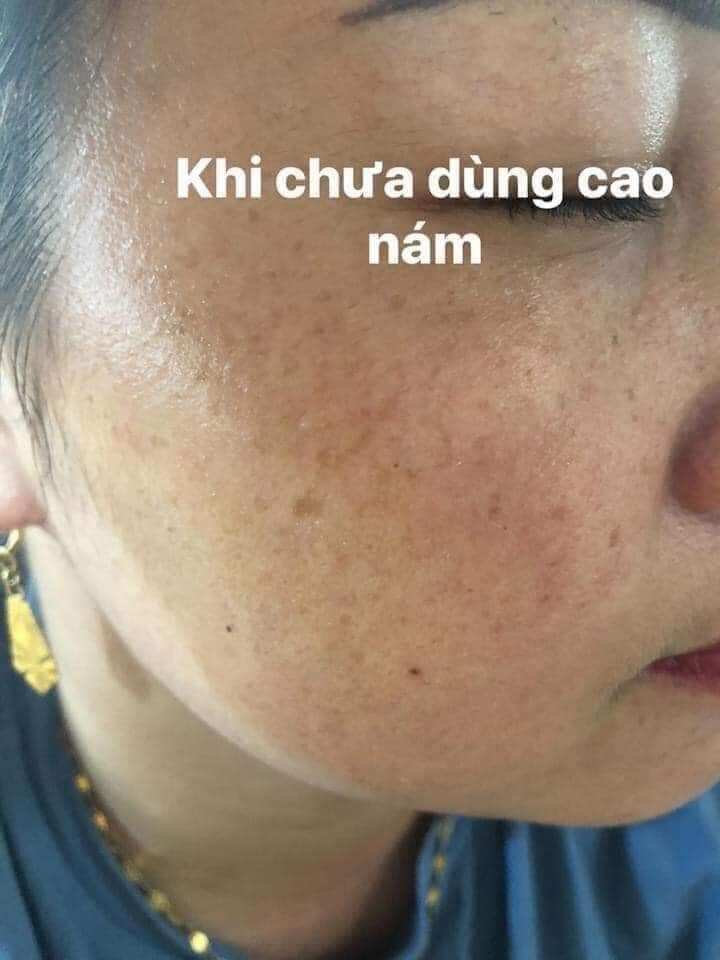 Cao Nám Hoàng Cung Magic skin (hộp 13g)