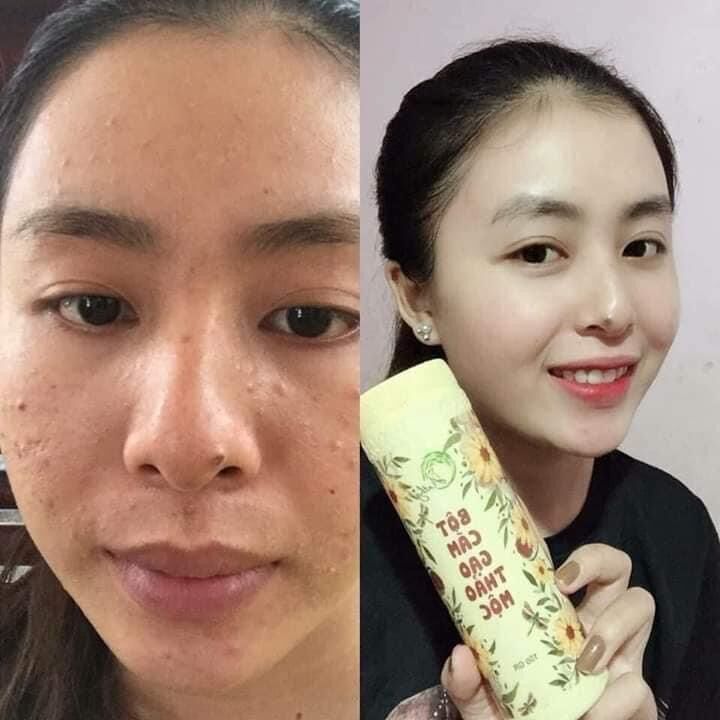 Cám Gạo Thảo Mộc AnThy ( Date mới )