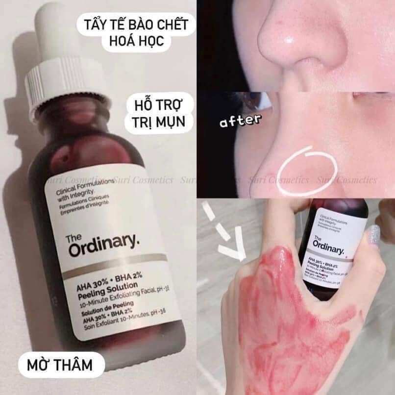 Peel đã The Ordinary AHA 30%-BHA  2%