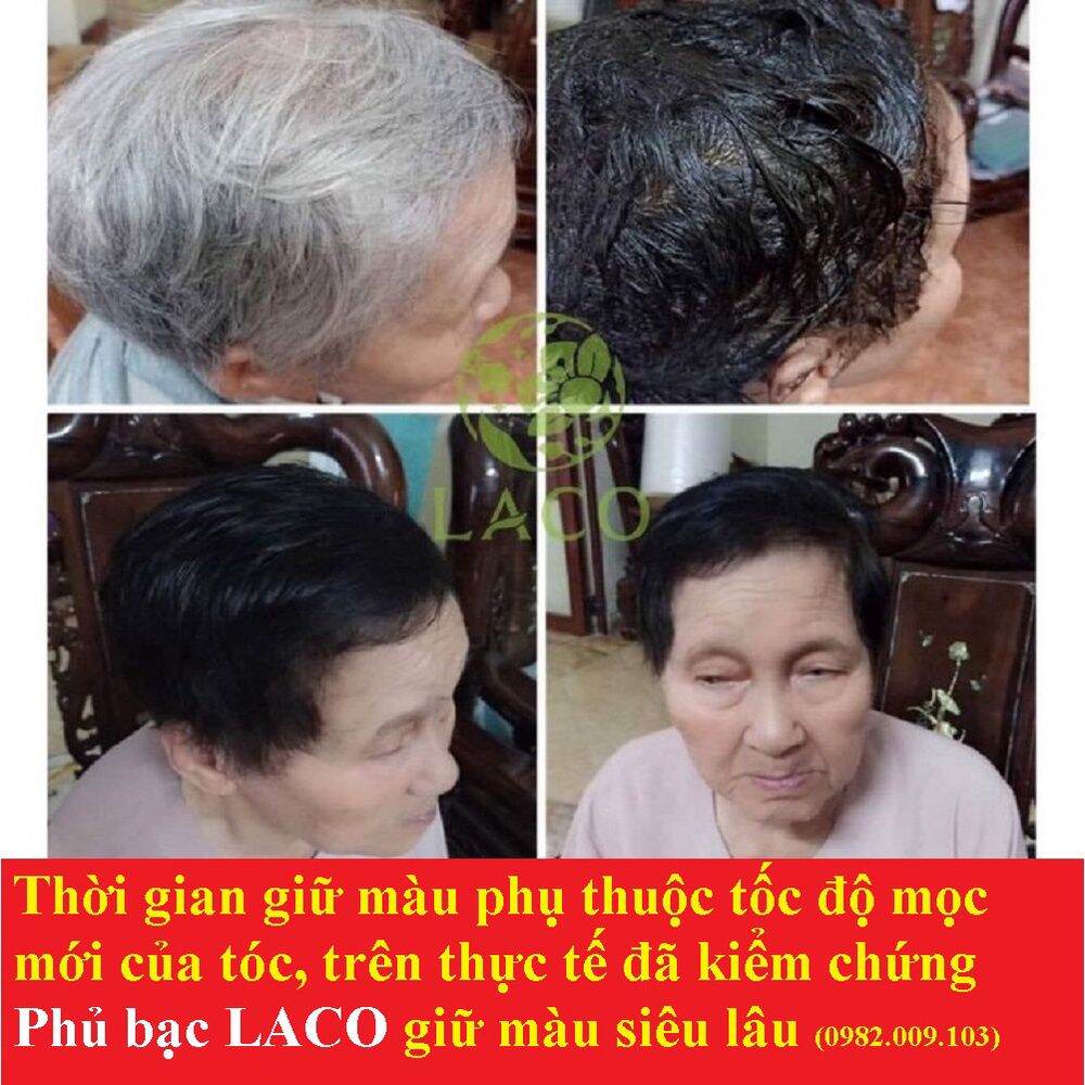 Dầu Gội Phủ Bạc LACO Chính Hãng
