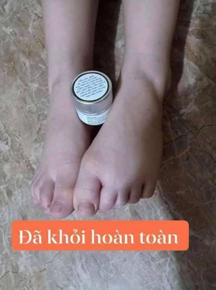 thảo mộc bôi da