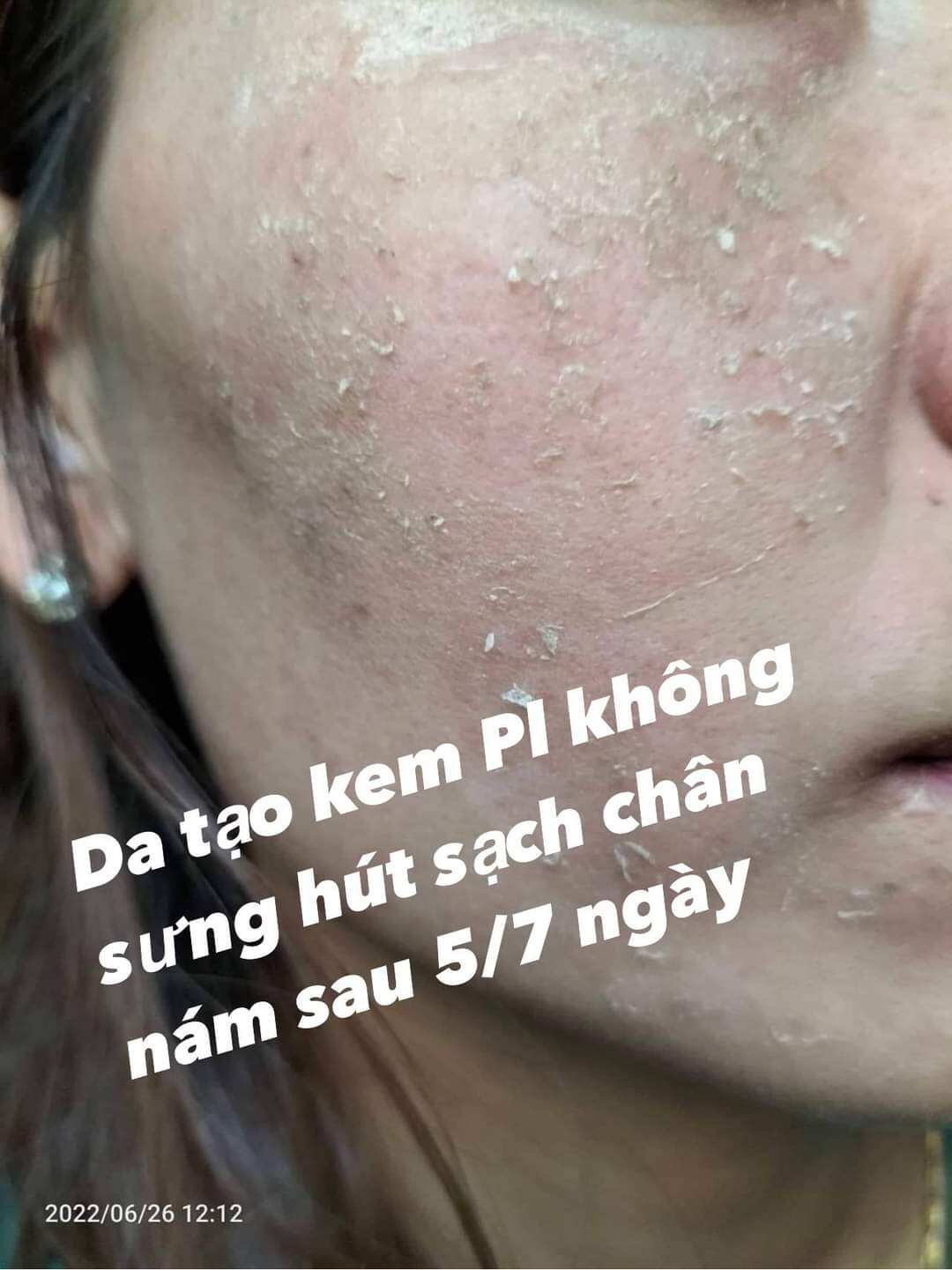 kem face bong da