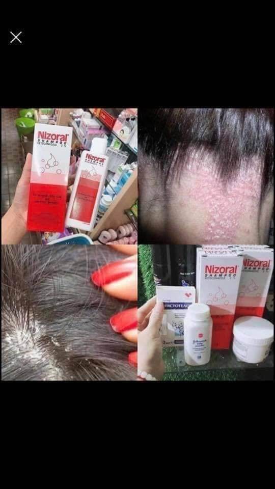 👉 #DẦU_GỘI_TRỊ_GÀU - #NẤM_DA_ĐẦU 👌