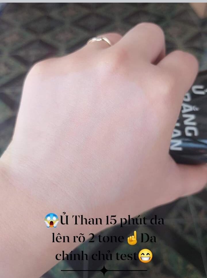 Ủ Trắng Than Huỳnh Đỗ (kèm quà tặng)