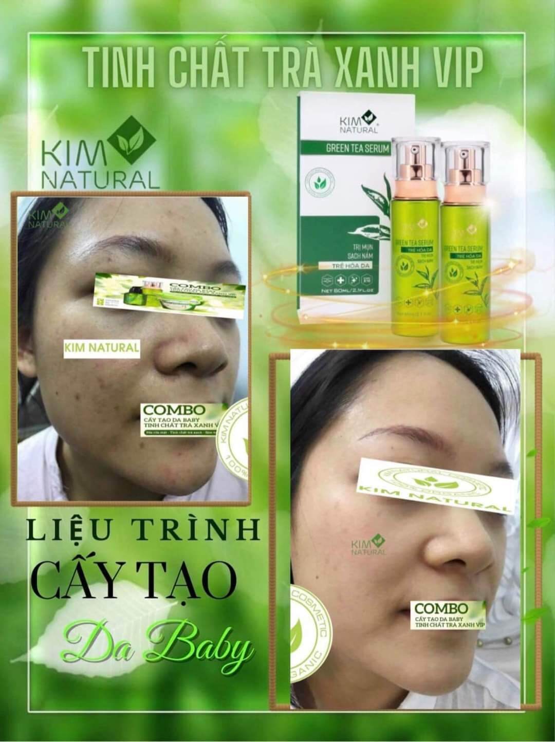 COMBO SERUM TRÀ XANH VIP TÁI TẠO LÀN DA