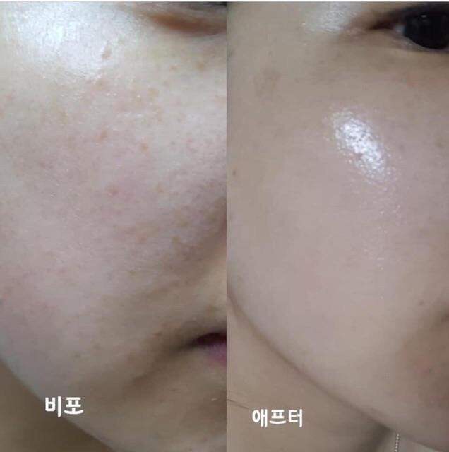 Vi kim tảo biển thay da sinh học CareCella Venus Peel Hàn Quốc (full set)