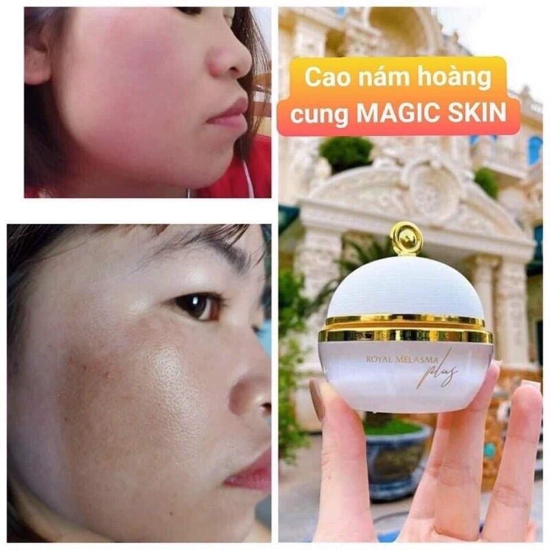Cao Nám Magic Skin Hũ To 40gram