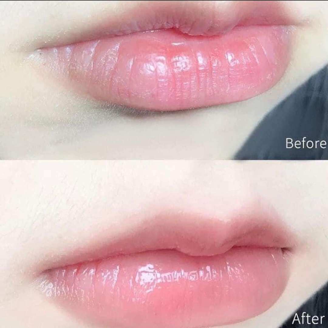 KEM NẺ VASELINE 49g mini