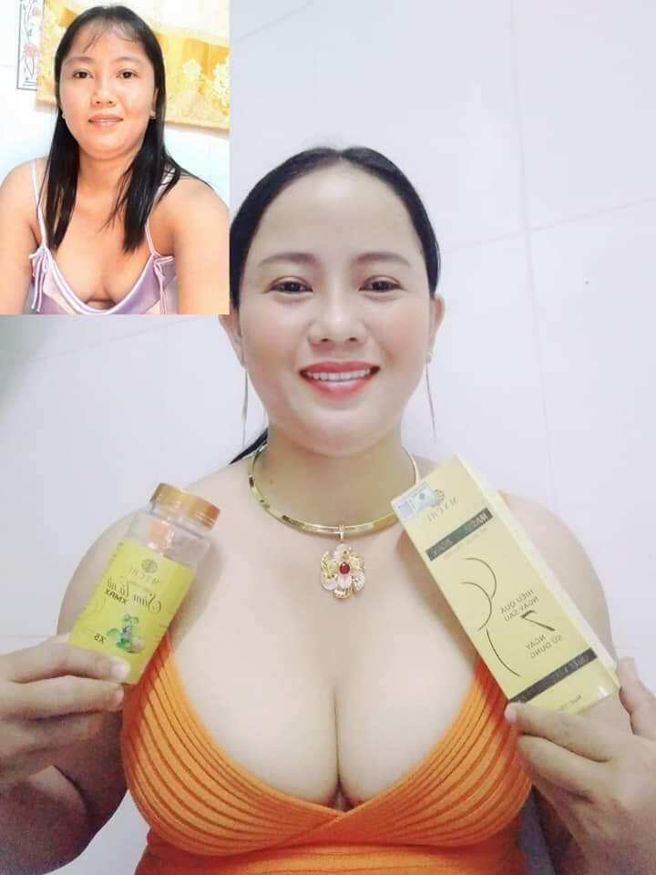 Combo 5hộp mầm sâm tố nữ xmax và 1kem massage nở ngực siêu tốc sau 7 ngày. mychi