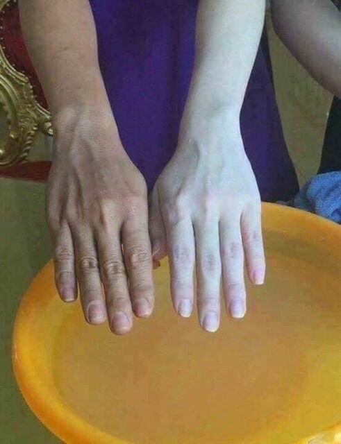 Combo kem trộn trắng nhanh cấp tốc