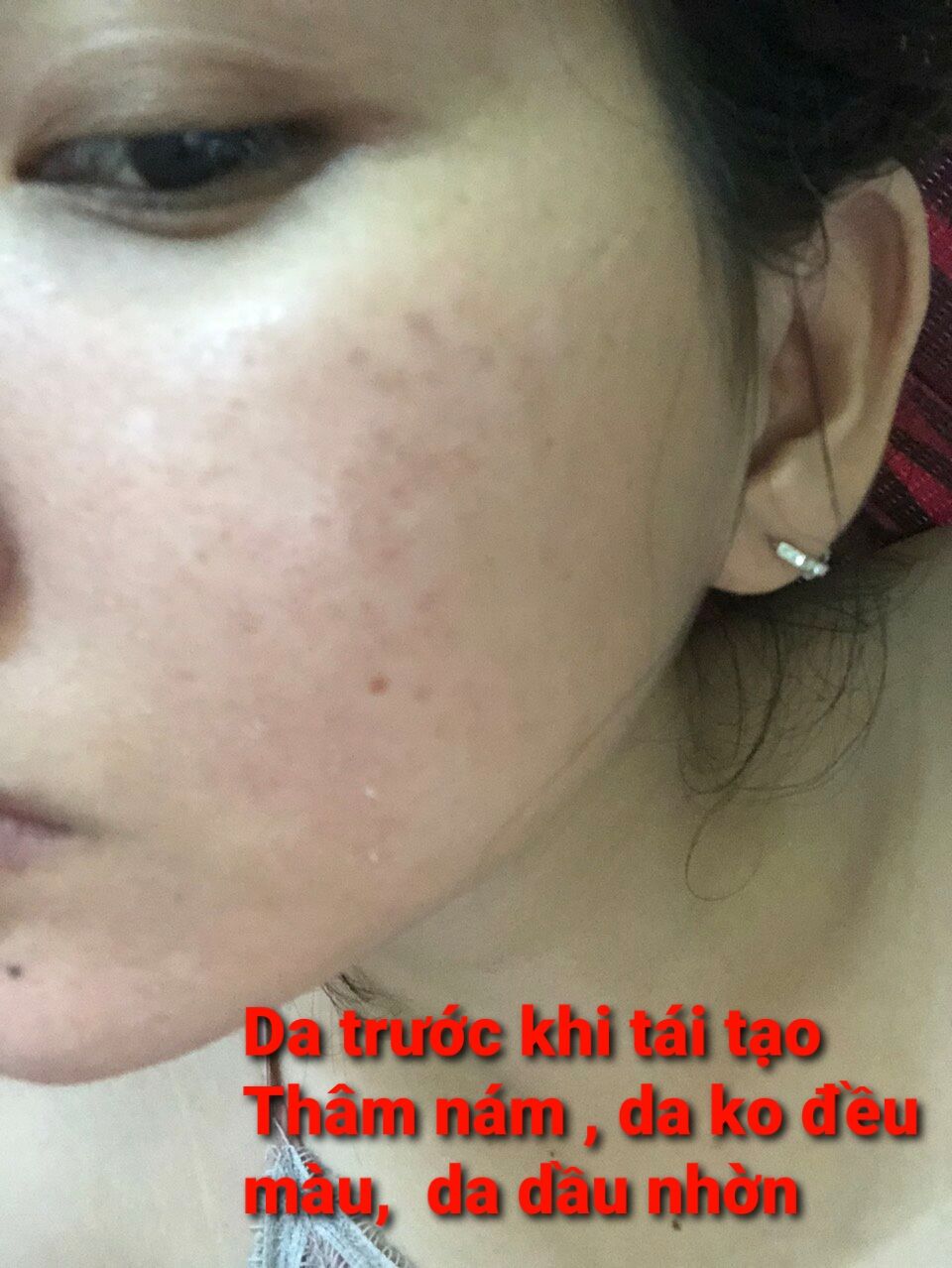 HỒNG SÂM TÁI TẠO