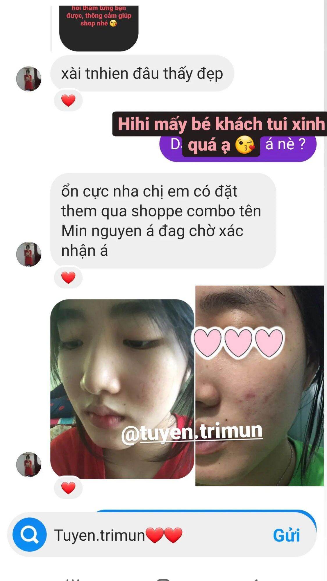 Đông y Sắc Ngọc Nữ  tái tạo da mụn, thâm