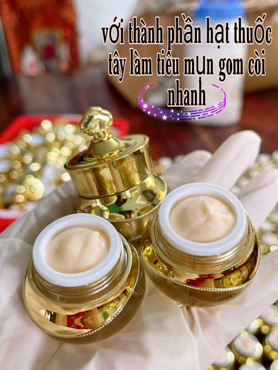 Kem giảm mụn