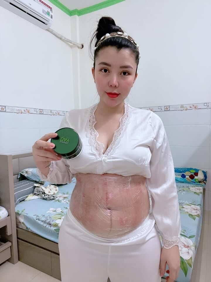 [ CHÍNH HÃNG ] KEM TAN MỠ BỤNG SLIMMING BODY