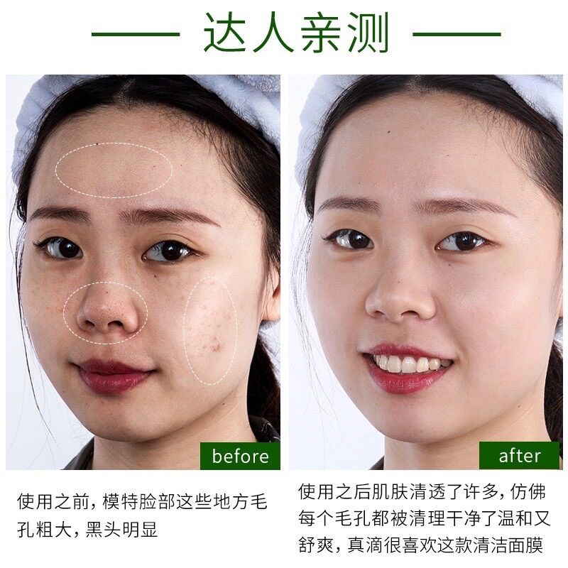 Mặt nạ sủi bọt bì heo thải độc tố cho da 100ml