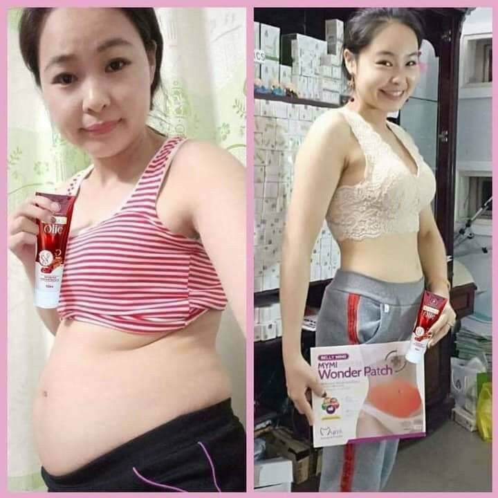 (Combo 1 tan mỡ+5 miếng cao dán) kem tan mỡ quế Olic
