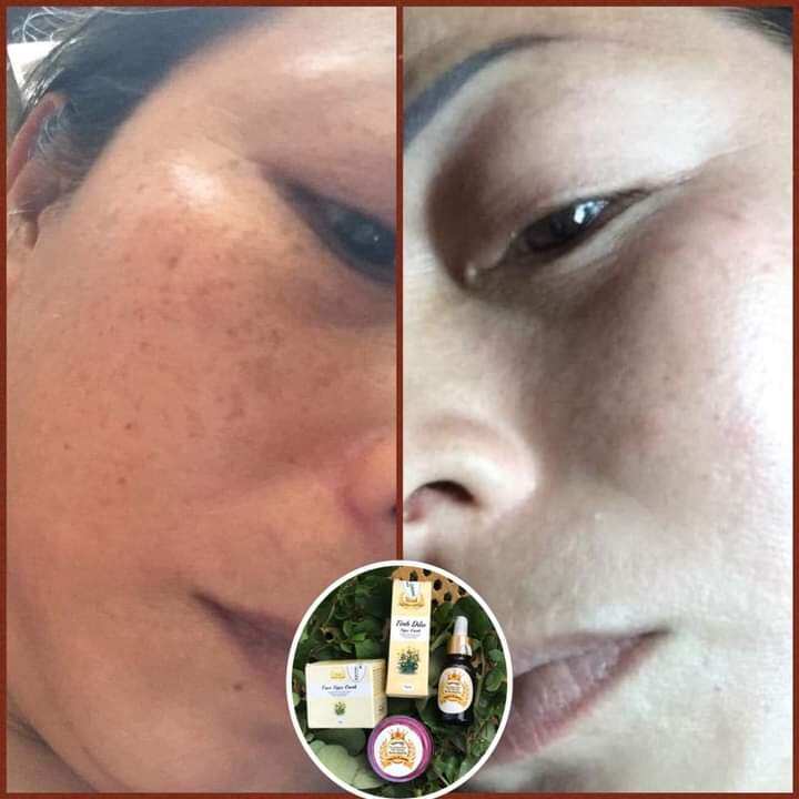 kem face Ngọc Oanh