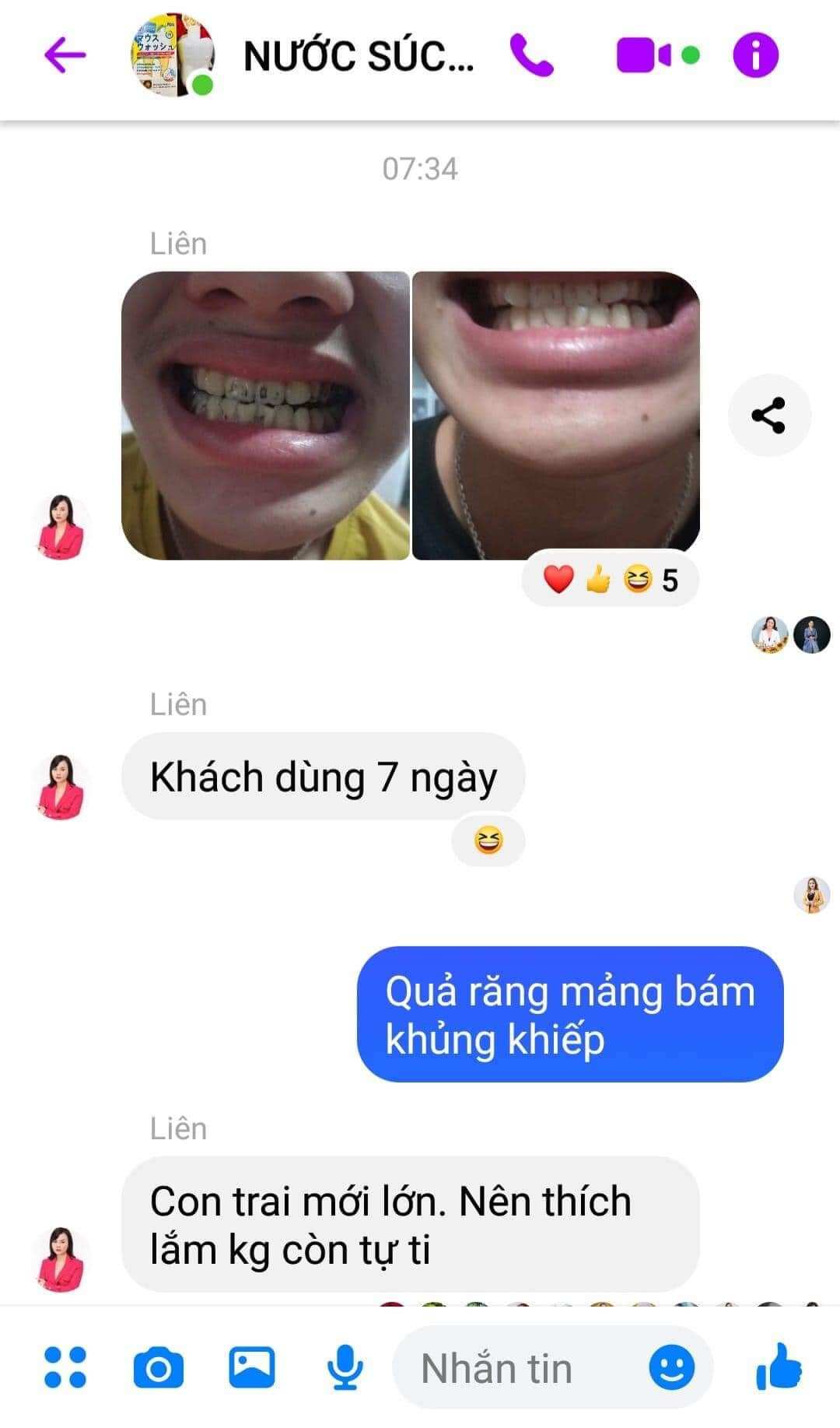 (Chính Hãng) Combo 3 Chai Nước Súc Miệng Dental Care