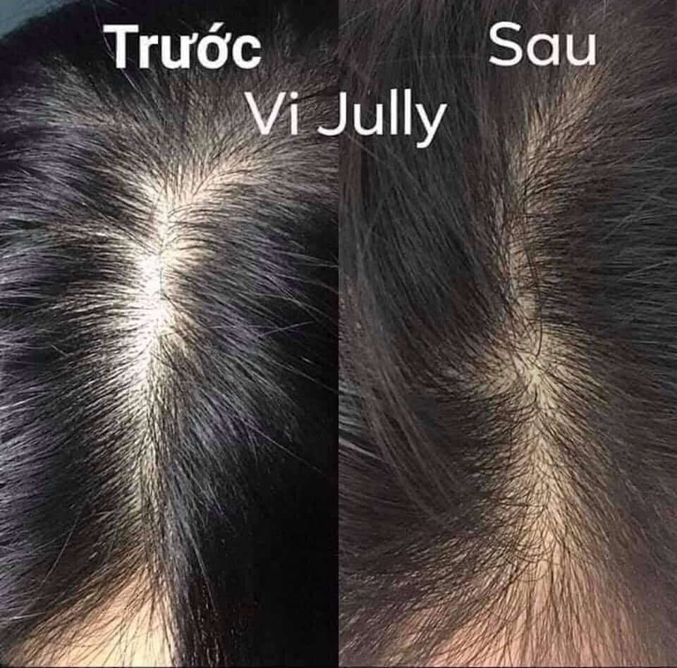 Xịt Mọc Tóc Vijully Kích Thích Tóc Mọc ,Ngăn Rụng Tóc ,150ml