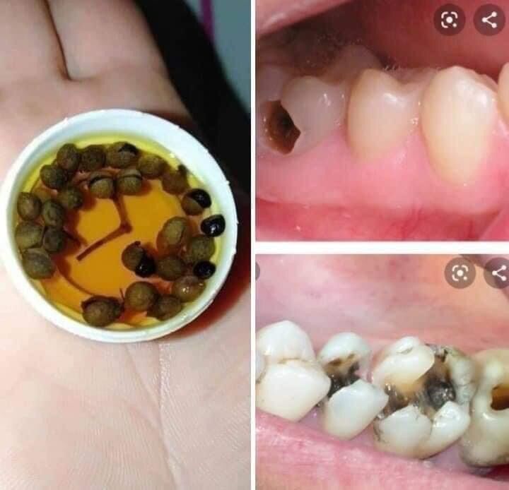 Khỏi Sâu Răng Của Dân Tộc Dao