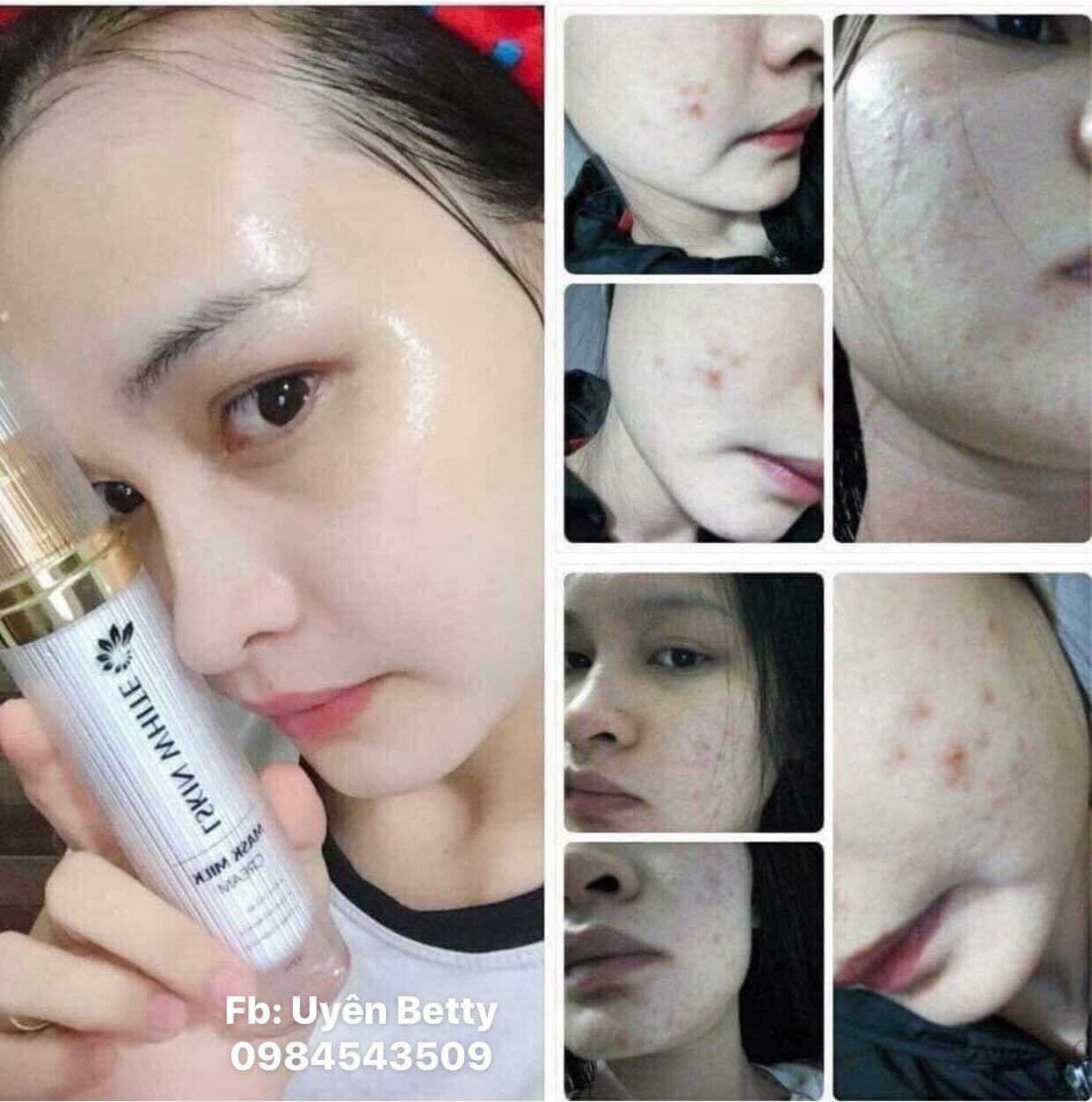 [Ủ Trắng Kén Tằm Hàng chính Hãng]
