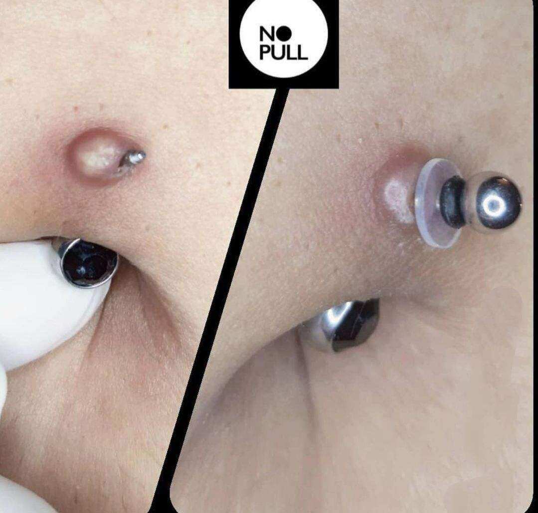 MIẾNG NẸP BUMP - Miếng Nopull Disc (7mm/9mm) - Đệm siết (3mm) - Miếng nẹp bump tai, mũi, rốn, môi, lưỡi,...