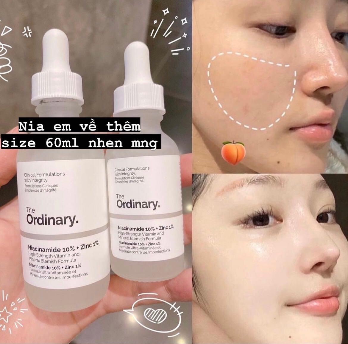 Serum The Ordinary Niacinamide 10% + Zinc 1% 60Ml